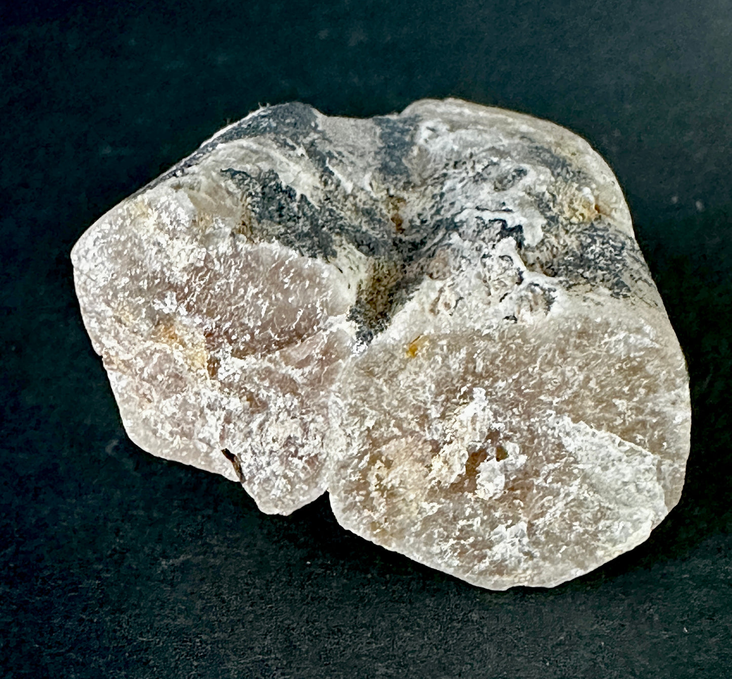 hydroxyapatite "V" twin