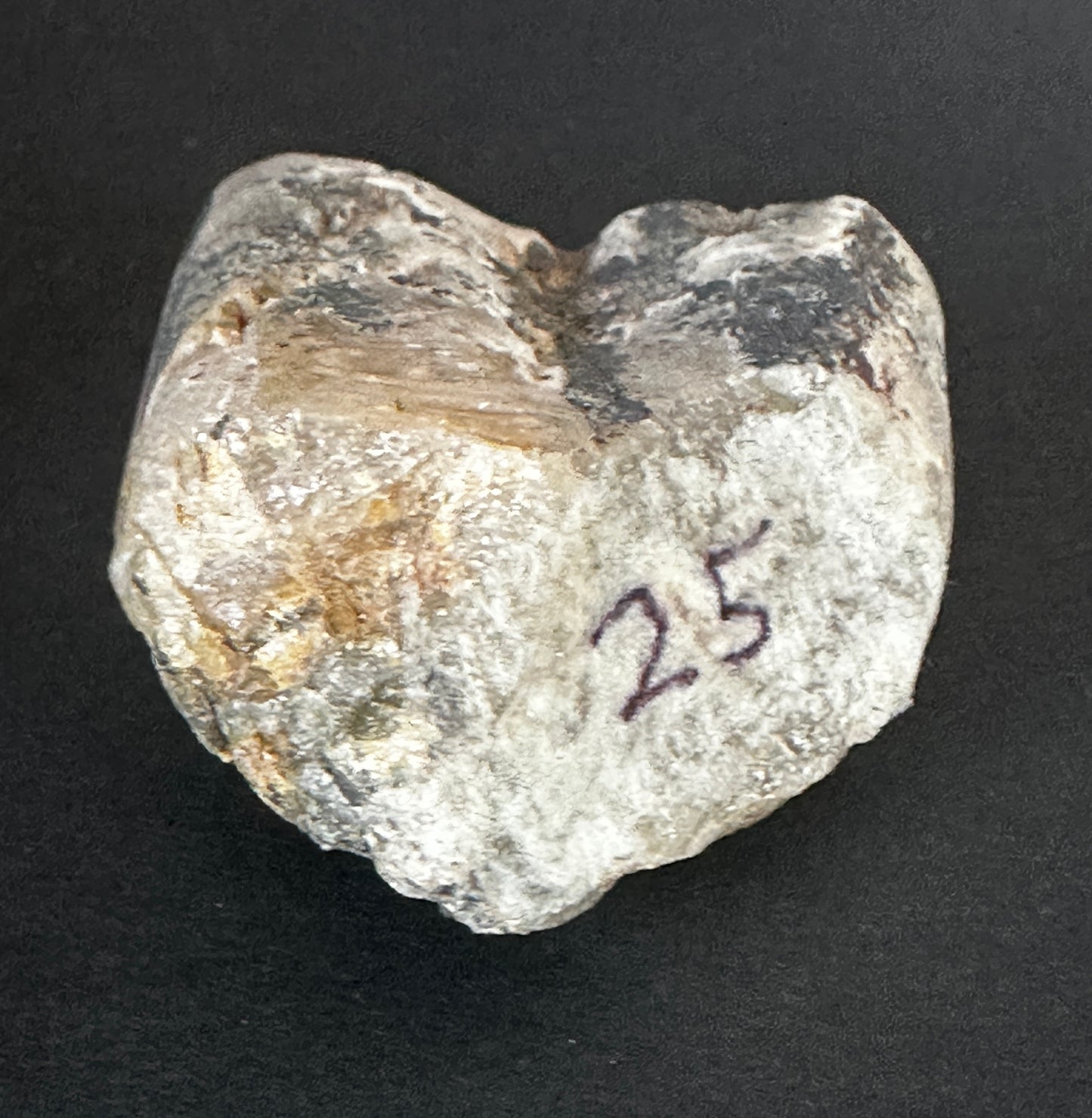 hydroxyapatite "V" twin